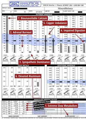 Sample HTMA report - Mineral graph analysis